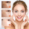 Melasma Removal Cream Niacinamide Brightening Reduce Melanin Facial Cream Lighten Dark Skin Shrink Pores Moisturizer Skin Care. 