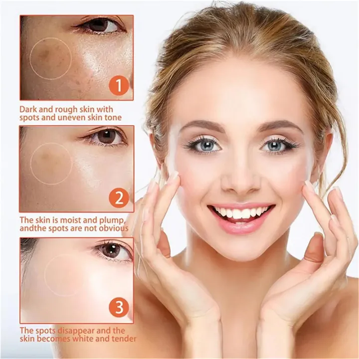 Melasma%20Removal%20Cream%20Niacinamide%20Brightening%20Reduce%20Melanin%20Facial%20Cream%20Lighten%20Dark%20Skin%20Shrink%20Pores%20Moisturizer%20Skin%20Care%20-%20Image%203