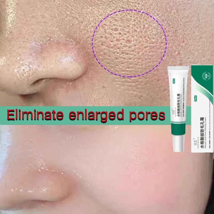 Salicylic Acid Pores Shrink Refining Cream Repair Large Open Pore Removal Black Dots Blackhead Acne Marks Facial Skin Care Serum