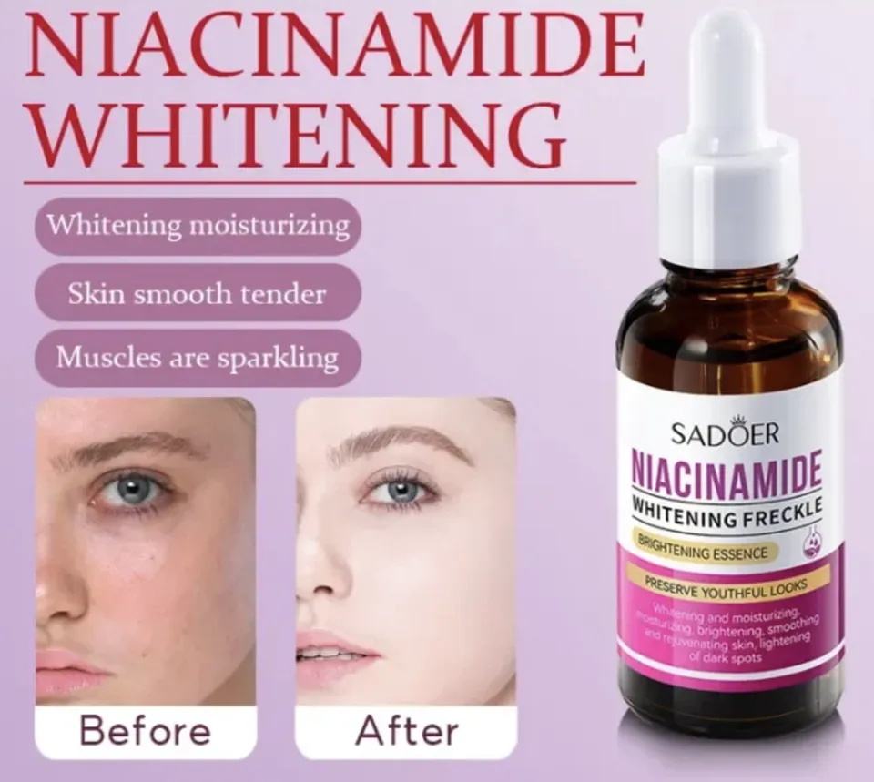 SADOER Niacinamide Whitening Anti-Freckle Face Serum, Black Spot