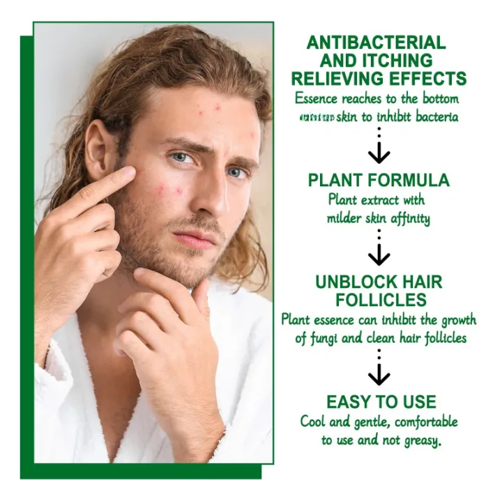 Hair%20Follicle%20Cream%20Treat%20Scalp%20Hair%20Folliculitis%20Skin%20Inflammation%20Cysts%20Papules%20Spot%20Remover%20Body%20Acne%20Anti%20Itching%20Ointment%20-%20Image%203