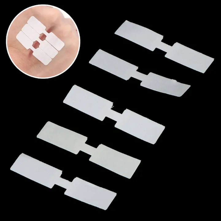 10Pcs%20Waterproof%20Butterfly%20Adhesive%20Band%20Aid%20Wound%20Closure%20Emergency%20Bandages%20-%20Image%206