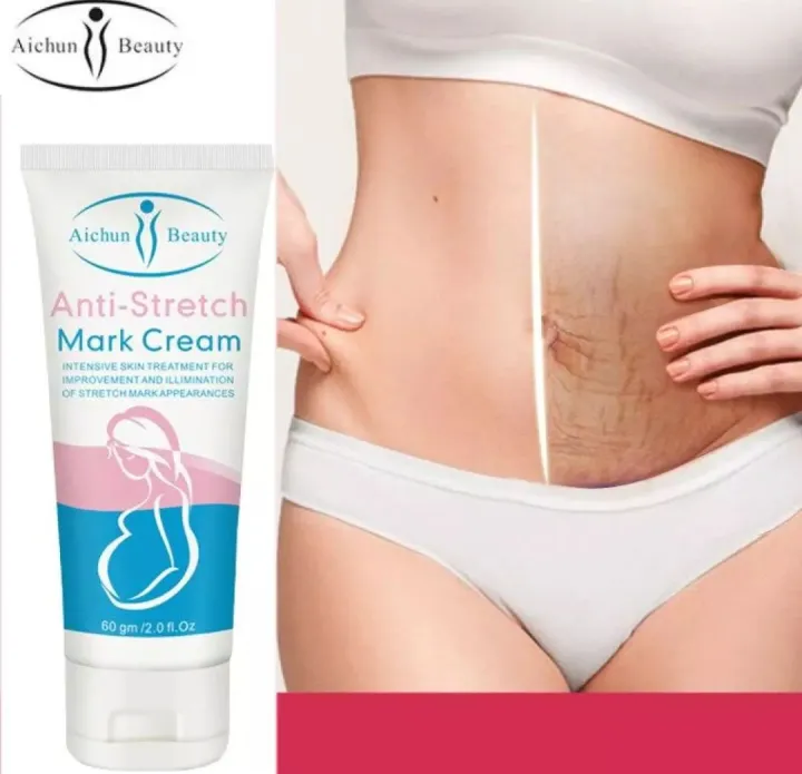 Aichun%20Beauty%20Anti-Stretch%20Marks%20Cream%20%7C%20Stretch%20Marks%20Removal%20Cream%20-%20Image%202