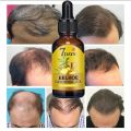 Fast Hair Growth Oil Ginger Growth Hair Treatment Anti Hair Loss Men Women Scalp Treatment Serum Products Beauty Health Product. 