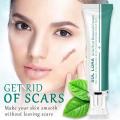 Effective Recovery Scar Cream Fast Removal Surgery Scars Healing Stretch Marks Acne Pox Prints Repair Smooth Whitening Skin Care.