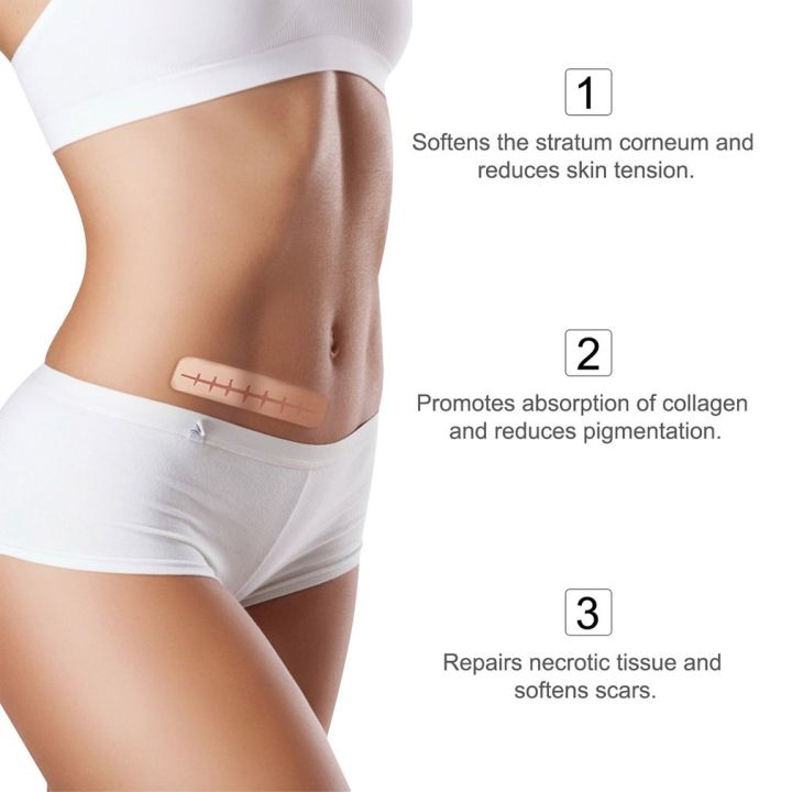 %E3%80%90Sleek%E3%80%91%20Scar%20Sheets%20Patch%20Painless%20Scar%20Repair%20Tape%20Roll%20Effective%20Scar%20Removal%20Strips%20For%20C-Section%20Keloid%20Surgery%20Burn%20Acne%20-%20Image%206