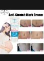 Aichun Beauty Anti-Stretch Marks Cream | Stretch Marks Removal Cream. 