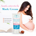 Aichun Beauty Anti-Stretch Marks Cream | Stretch Marks Removal Cream 60g. 