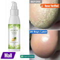 EELHOE Anti Crack Foot Hand Gel Ginger Cuticles Care Anti-Drying Healing Crack Frost Mask Dead Skin Removal Deep Moisturizing Feet Crack Whitening Smooth Feet Care.