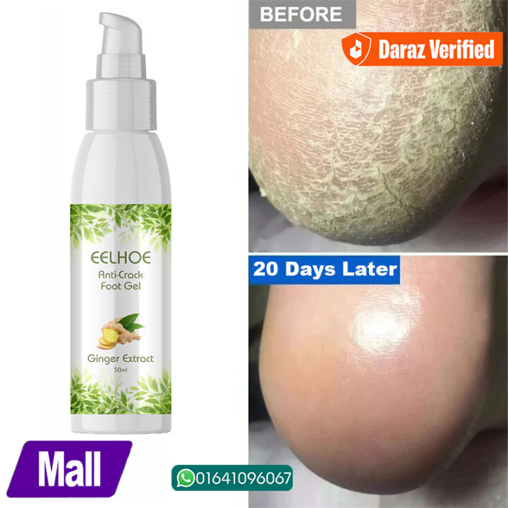 EELHOE%20Anti%20Crack%20Foot%20Hand%20Gel%20Ginger%20%20Cuticles%20Care%20Anti-Drying%20Healing%20Crack%20Frost%20Mask%20Dead%20Skin%20Removal%20Deep%20Moisturizing%20Feet%20Crack%20Whitening%20Smooth%20Feet%20Care%20-%20Image%202