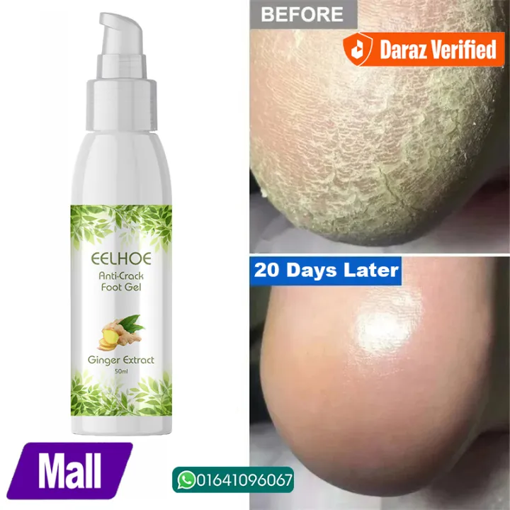 EELHOE%20Anti%20Crack%20Foot%20Hand%20Gel%20Ginger%20%20Cuticles%20Care%20Anti-Drying%20Healing%20Crack%20Frost%20Mask%20Dead%20Skin%20Removal%20Deep%20Moisturizing%20Feet%20Crack%20Whitening%20Smooth%20Feet%20Care%20-%20Image%202