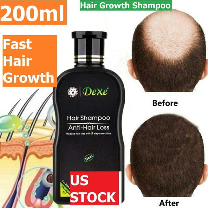 Ml Dexe Anti Hair Loss Shampoo Natural Herbal Hair Growth Treatment Women Men Daraz Com Bd