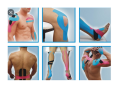Kinesiology Sports Taping. 