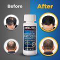 Kirkland Minoxidil 5% for Beard & Hair Growth.