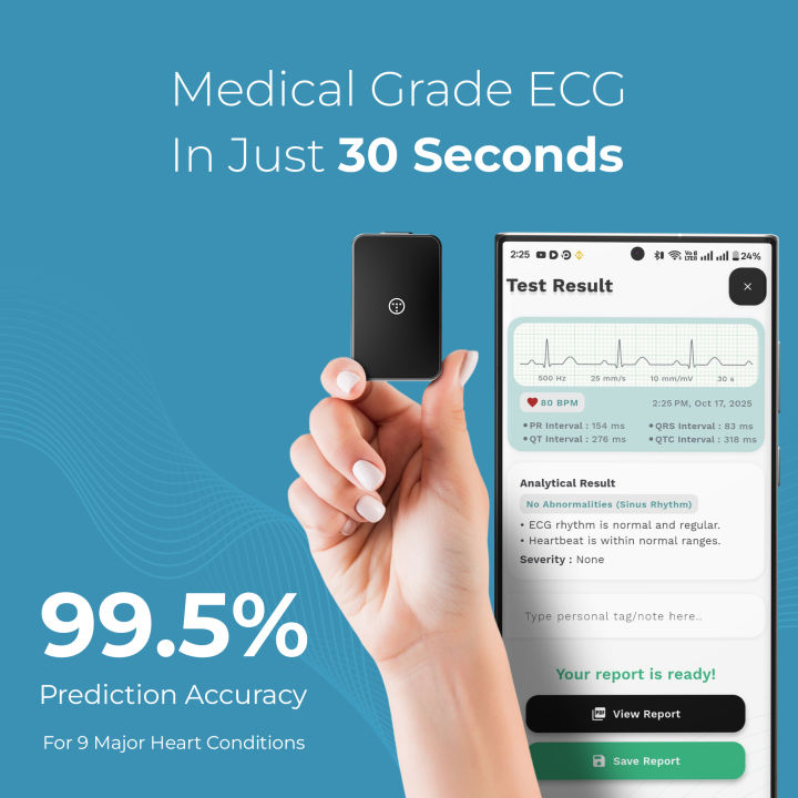 myECGai (Basic)| Portable ECG Machine | Medical Grade Single Lead ECG ...