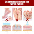 10-1pair Exfoliating Feet Mask Sock Pedicure Peeling Foot Socks Pedicure Sock Scrub Dead Skin Remover For Feet Mask Foot Care. 