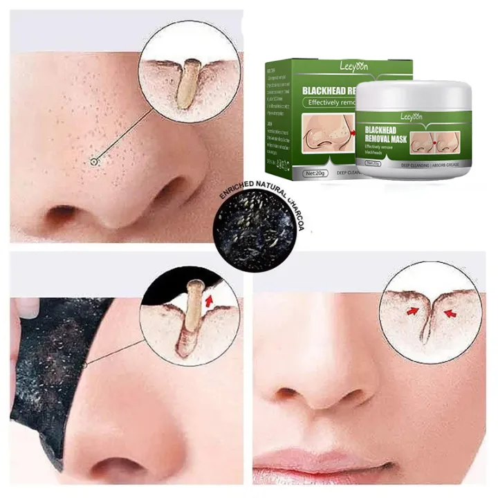 Black%20Peel%20off%20Mask%20Facial%20Blackhead%20Remover%20Mask%20Shrink%20Pores%20Acne%20Black%20Head%20Removal%20Nose%20Cleansing%20Skin%20Care%20-%20Image%203