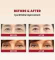 KSECRET SEOUL 1988 EYE CREAM : RETINAL LIPOSOME 4% + FERMENTED BEAN 30ML. 