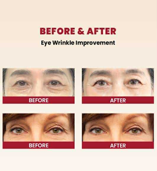 KSECRET%20SEOUL%201988%20EYE%20CREAM%20:%20RETINAL%20LIPOSOME%204%25%20+%20FERMENTED%20BEAN%2030ML%20-%20Image%206