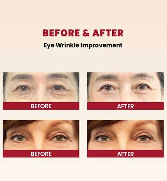 KSECRET%20SEOUL%201988%20EYE%20CREAM%20:%20RETINAL%20LIPOSOME%204%25%20+%20FERMENTED%20BEAN%2030ML%20-%20Image%206