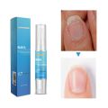 Repair Nail Fungus Treatments Essence Foot Care Serum Toe Nails Fungal Removal Gel Anti-Infection Onychomycosis Nail Care 4ml. 