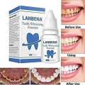 Lanbena Teeth Whitening Essence 10ml [Grab Cosmic House]. 