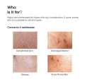 Minimalist Dehydrated Skin Moisturizer with 10% Vitamin B5 for Oily & Acne-Prone Skin | Oil-Free Hydration & Lightweight Gel Formula for Damaged Barrier Repair | Fast-Absorbing & Non-Sticky Lightweight Winter Cream For Women & Men | Fragrance-Free | 50 gr. 