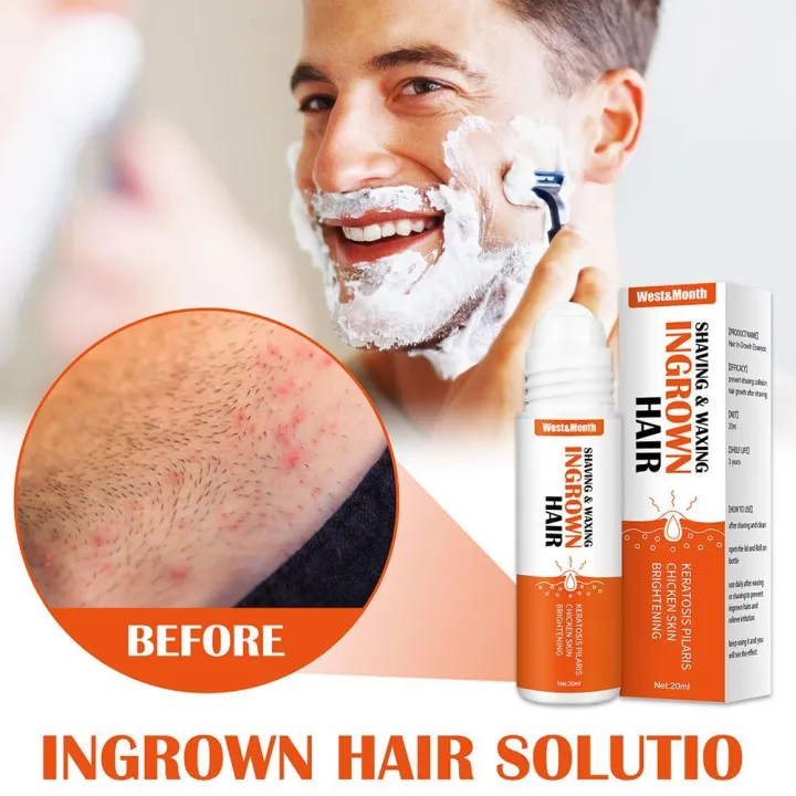Ingrown%20hair%20after%20shaving%20treatment%20for%20dark%20spots%20repair%20serum%20M2Z1%20-%20Image%202