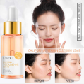 LAIKOU Vitamin C Face Serum Brighten Skin Tone Anti oxidant. 