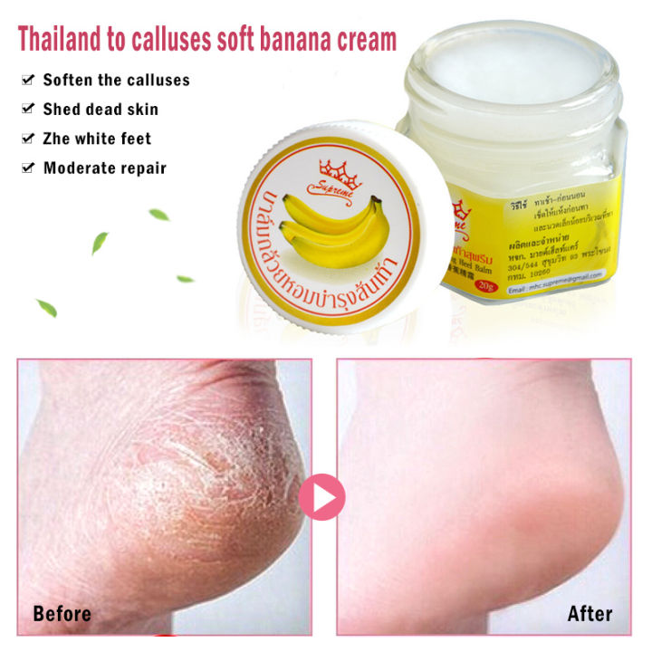 20g%20Vaseline%20Moisturizing%20Hand%20Foot%20Dead%20Skin%20Remover%20Banana%20Oil%20Anti-dry%20Crack%20Foot%20Cream%20Cracked%20Heel%20Repair%20Feet%20Care%20Cream%20-%20Image%206