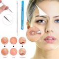 Blackhead Remover Tool Acne Pimple Spot Extractor Pin - 1 PCS. 