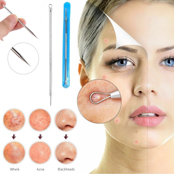 Blackhead%20Remover%20Tool%20Acne%20Pimple%20Spot%20Extractor%20Pin%20-%201%20PCS%20-%20Image%202