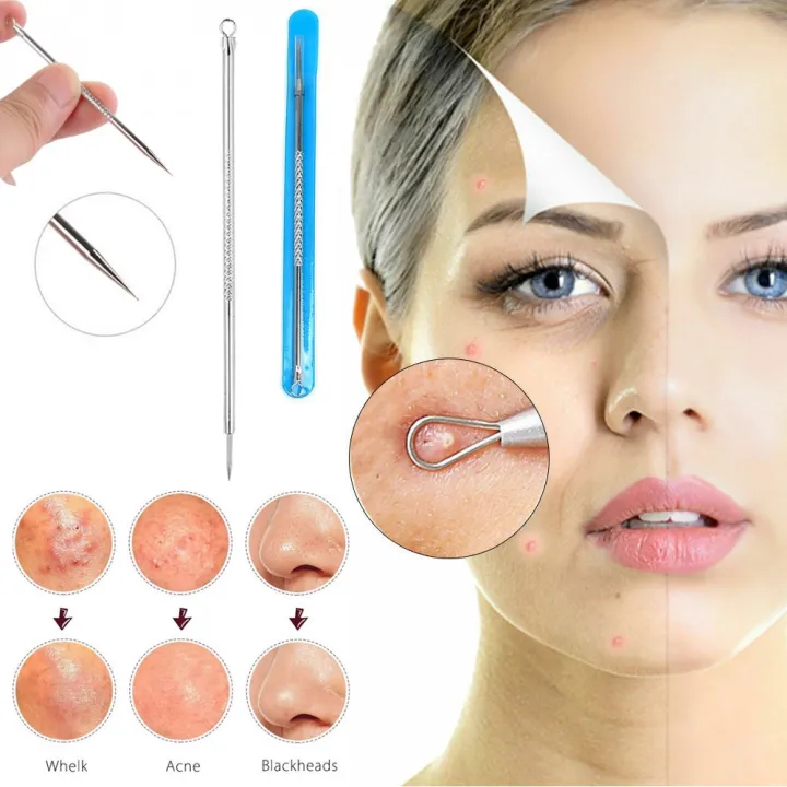 Blackhead%20Remover%20Tool%20Acne%20Pimple%20Spot%20Extractor%20Pin%20-%201%20PCS%20-%20Image%202