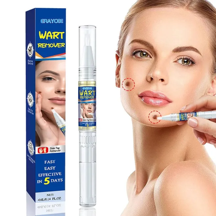 Wart%20Removing%20Pen%20-%20Image%203