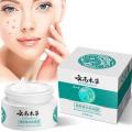 20g YunNan Herb Whitening Freckles Cream Remove Melasma Fade Dark Spots Shrink Pores Brightening Anti-aging Skin Care Product. 
