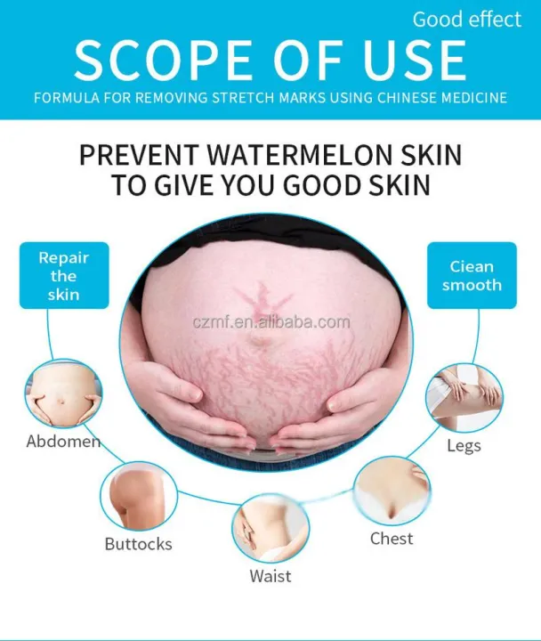 Natural%20Organic%20Postpartum%20Stretch%20Mark%20Removal%20Skin%20Repair%20Cream%20Body%20Pregnancy%20Scar%20Cream%20For%20Women%20-%20Image%206