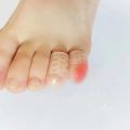 Silica Gel Breathable Protective Toe Case for Shoes - Wholesale.