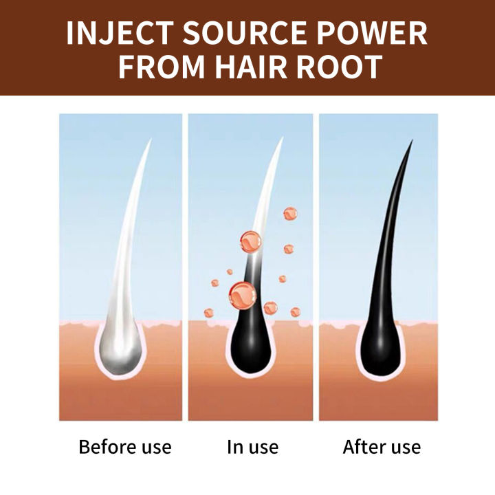 Chines%20Herbal%20Polygonum%20multiflorum%20hair%20soap%20Blacken%20hair%20and%20prevent%20hair%20loss%2060g-Get%201%20Foam%20Net%20Free%20-%20Image%207