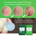 【DIV MALL】Patch Pimple Stickers Pimple Remover Spot Facial Mask. 