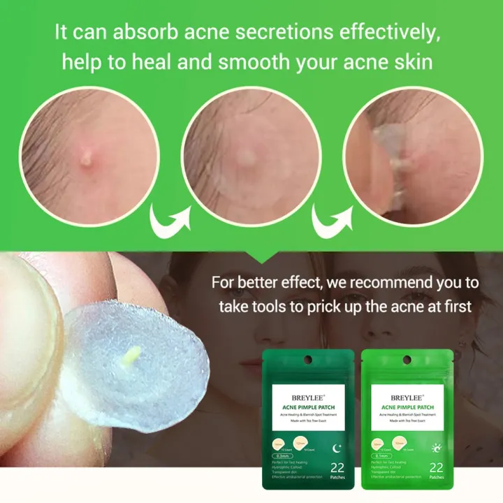 %E3%80%90DIV%20MALL%E3%80%91Patch%20Pimple%20Stickers%20Pimple%20Remover%20Spot%20Facial%20Mask%20-%20Image%207