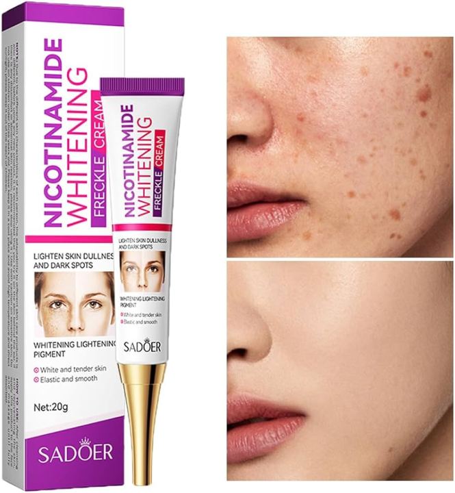 SADOER Niacinamide Whitening Freckle Cream Effectively Removes Melasma Lightens Black Spots Acne Marks Brightens Skin Care-20gm