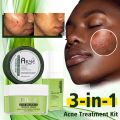 AILKE Natural Acne Treatment Skin Care, Plant Formulation, Prevent Breakouts, Defeat Acne Prone Skin, Fast Cleaning Pimple. 