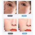 Mini Freckle Removal Pen Portable Skin Mole Dark Spot Face Wart Tag Tattoo Removal Device Skin Care Tool. 