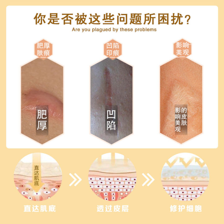 To%20remove%20scars%20for%20children,%20baby%20scar%20removal,%20scar%20removal,%20scar%20removal,%20special%20children,%20for%20babies%20and%20toddlers%20to%20remove%20facial%20scar%20cream%20-%20Image%203