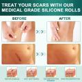 1 Roll Efficient Beauty Self-Adhesive Silicone Gel Tape Removal Scar Tape Therapy Patch for Acne Trauma Burn Scar Skin Repair. 