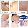 Vaseline Glutamine Whitening Body Lotion Highly Concentrated Niacinamide Hyaluronic Acid Brightens Skin Deeply Hydrating 330ml.
