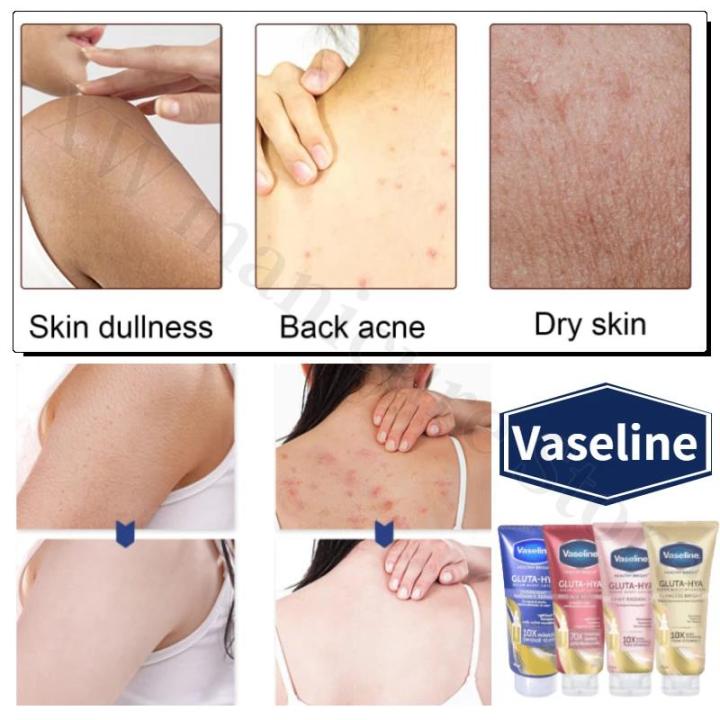 Vaseline%20Glutamine%20Whitening%20Body%20Lotion%20Highly%20Concentrated%20Niacinamide%20Hyaluronic%20Acid%20Brightens%20Skin%20Deeply%20Hydrating%20330ml%20-%20Image%204