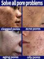 Pore Shrinking Serum Face Removing Large Pores Tightening Repairing Large Pores Facial Pore Minimizing Cream.