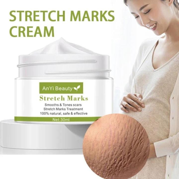 Pregnancy%20Stretch%20Mark%20Repair%20Cream%20Stretch%20Scar%20Marks%20Remover%20Maternity%20Obesity%20Treatment%20Body%20Postpartum%20Smooth%20Skin%20Care%20-%20Image%202