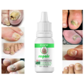 Repair Nail Fungus Treatment Serum Toe Fungal Repair Products Hand Foot Care Removal Gel Anti Infection Onychomycosis Paronychia.